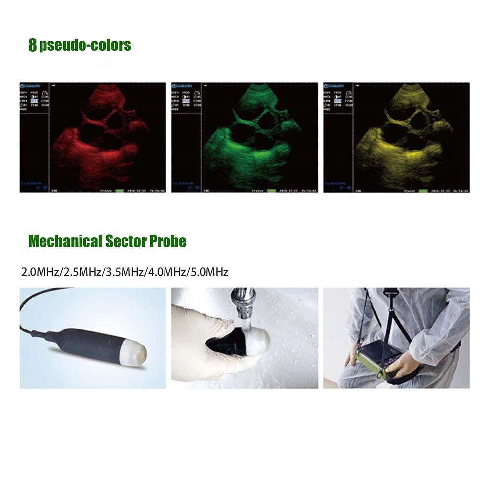 DAWEI Portable Veterinary Ultrasound Scanner For Pregnancy 3.5MHz Convex Probe